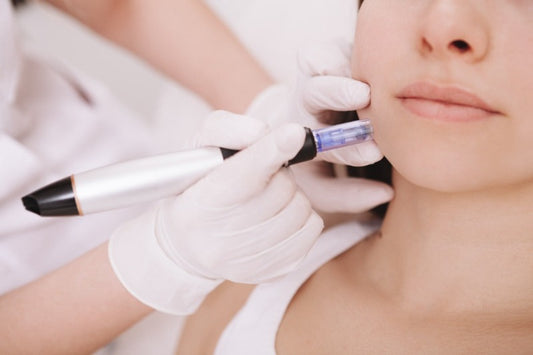 Microneedling